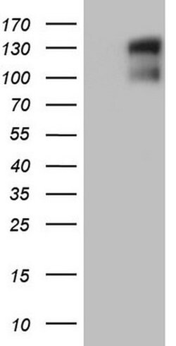 GLI1 Monoclonal Antibody (OTI1B5), TrueMAB , OriGene:Antibodies:Primary