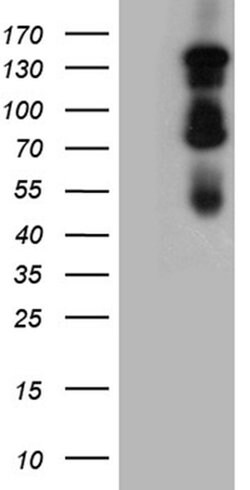 GLI1 Monoclonal Antibody (OTI2B3), TrueMAB , OriGene:Antibodies:Primary