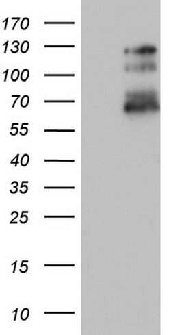 GLI1 Mouse anti-Human, Clone: OTI1B1, lyophilized, TrueMAB 100 &mu;g; Unconjugated:Antibodies,