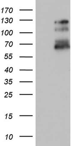 GLI1 Monoclonal Antibody (OTI1B1), TrueMAB , OriGene 100 &mu;L; Unconjugated:Antibodies,