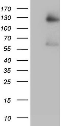 GLI1 Monoclonal Antibody (OTI1A8), TrueMAB , OriGene:Antibodies:Primary