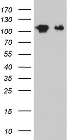 GLI1 Monoclonal Antibody (OTI2E5), TrueMAB , OriGene:Antibodies:Primary