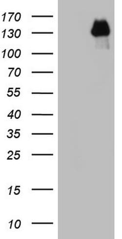GLI1 Mouse anti-Human, Clone: OTI1E5, lyophilized, TrueMAB 100 &mu;g; Unconjugated:Antibodies,
