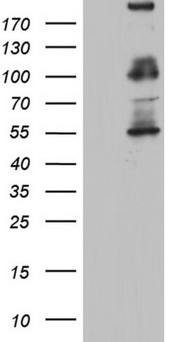 GLI1 Mouse anti-Human, Clone: OTI4C1, lyophilized, TrueMAB 100 &mu;g; Unconjugated:Antibodies,
