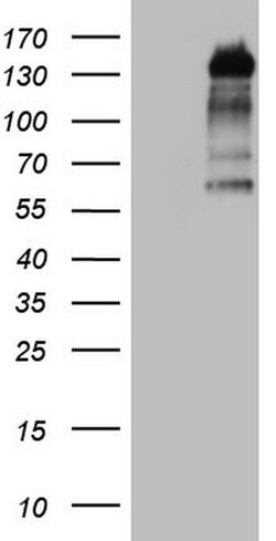 GLI1 Mouse anti-Human, Clone: OTI2D5E12, lyophilized, TrueMAB 100 &mu;g;