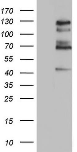 GLI1 Monoclonal Antibody (OTI2C10), TrueMAB , OriGene 100 &mu;L; Unconjugated:Antibodies,