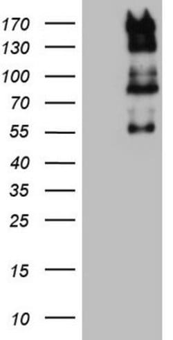 GLI1 Mouse anti-Human, Clone: OTI12D5, lyophilized, TrueMAB 100 &mu;g;