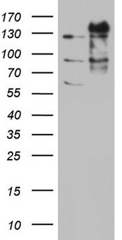 GLI1 Monoclonal Antibody (OTI9A1), TrueMAB , OriGene 100 &mu;L; Unconjugated:Antibodies,