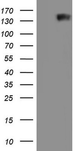 GLI1 Mouse anti-Human, Clone: OTI1C1, liquid, TrueMAB 100 &mu;L; Unconjugated:Antibodies,
