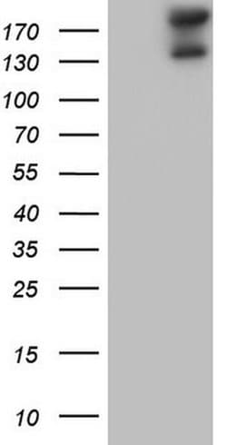 GLI2 Monoclonal Antibody (OTI1G2), TrueMAB , OriGene:Antibodies:Primary