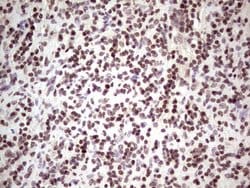 GLI4 Monoclonal Antibody (OTI3A9), TrueMAB , OriGene:Antibodies:Primary