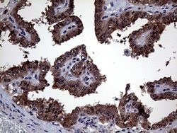 GLS2 Mouse anti-Human, Clone: OTI1C12, liquid, TrueMAB 100 &mu;L; Unconjugated:Antibodies,