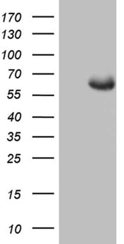 GLS2 Mouse anti-Human, Clone: OTI1C12, liquid, TrueMAB 100 &mu;L; Unconjugated:Antibodies,