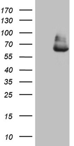 GLS2 Monoclonal Antibody (OTI6D11), TrueMAB , OriGene:Antibodies:Primary