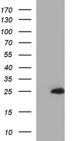 GLTP Monoclonal Antibody (OTI2A10), TrueMAB , OriGene:Antibodies:Primary