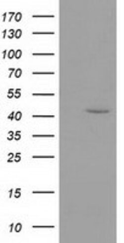 GMDS Mouse anti-Human, Clone: OTI2A1, lyophilized, TrueMAB 100 &mu;g; Unconjugated:Antibodies,