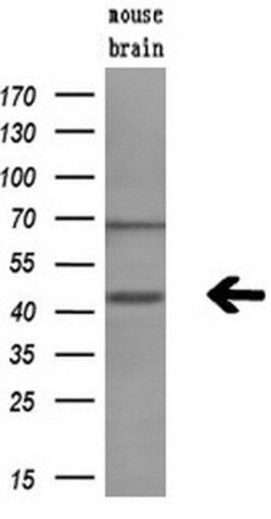 GMDS Mouse anti-Human, Clone: OTI2A1, lyophilized, TrueMAB 100 &mu;g; Unconjugated:Antibodies,