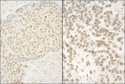 GMEB1 Rabbit anti-Human, Mouse, Polyclonal, Bethyl Laboratories 100 &mu;l;