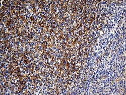 GNA14 Monoclonal Antibody (OTI3D3), TrueMAB , OriGene 100 &mu;L; Unconjugated:Antibodies,