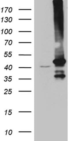 GNA14 Monoclonal Antibody (OTI3D3), TrueMAB , OriGene 100 &mu;L; Unconjugated:Antibodies,