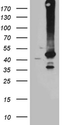 GNA14 Monoclonal Antibody (OTI3E8), TrueMAB , OriGene 100 &mu;L; Unconjugated:Antibodies,