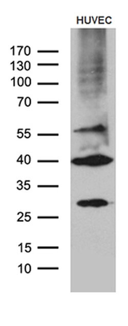 GNA14 Monoclonal Antibody (OTI3E8), TrueMAB , OriGene 100 &mu;L; Unconjugated:Antibodies,
