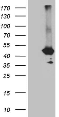 GNA14 Monoclonal Antibody (OTI9E9), TrueMAB , OriGene:Antibodies:Primary