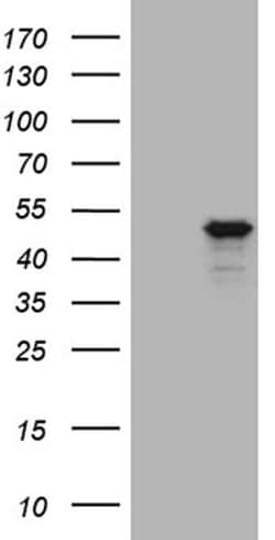 GNA15 Monoclonal Antibody (OTI1D3), TrueMAB , OriGene 30 &mu;L; Unconjugated:Antibodies,