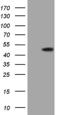 GNA15 Mouse anti-Human, Clone: OTI2D11, lyophilized, TrueMAB 100 &mu;g;