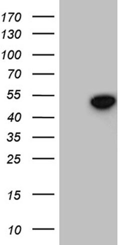 GNAS Mouse anti-Human, Clone: OTI7D7, lyophilized, TrueMAB 100 &mu;g; Unconjugated:Antibodies,