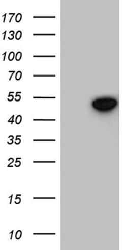 GNAS Monoclonal Antibody (OTI7D7), TrueMAB , OriGene:Antibodies:Primary