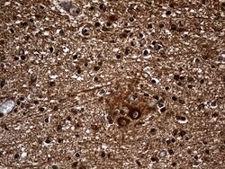 GNPAT Monoclonal Antibody (OTI1H1), TrueMAB , OriGene 100 &mu;L | Buy Online | OriGene | Fisher Scientific