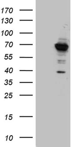 GNPAT Monoclonal Antibody (OTI2F8), TrueMAB , OriGene 100 &mu;L | Buy Online | OriGene | Fisher Scientific