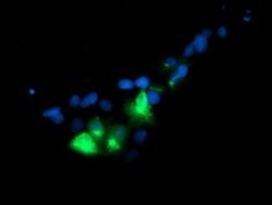 GOLM1 Monoclonal Antibody (OTI2F3), TrueMAB , OriGene 100 &mu;L; Unconjugated:Antibodies,