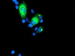 GOLM1 Mouse anti-Human, Clone: OTI2D6, lyophilized, TrueMAB 100 &mu;g;