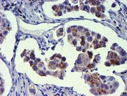 GOLM1 Monoclonal Antibody (OTI2F3), TrueMAB , OriGene 100 &mu;L; Unconjugated:Antibodies,