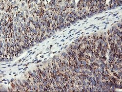 GOLM1 Monoclonal Antibody (OTI2D6), TrueMAB , OriGene 100 &mu;L | Buy Online | OriGene | Fisher Scientific