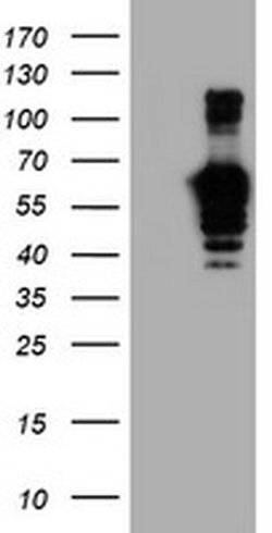 GOLM1 Monoclonal Antibody (OTI2F3), TrueMAB , OriGene 100 &mu;L; Unconjugated:Antibodies,