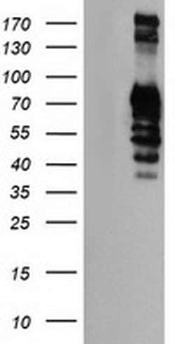 GOLM1 Monoclonal Antibody (OTI5F4), TrueMAB , OriGene 30 &mu;L; Unconjugated:Antibodies,