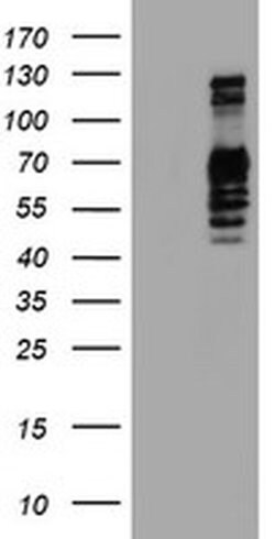 GOLM1 Monoclonal Antibody (OTI2D6), TrueMAB , OriGene 100 &mu;L | Buy Online | OriGene | Fisher Scientific