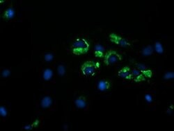 GORAB Monoclonal Antibody (OTI2E6), TrueMAB , OriGene 30 &mu;L; Unconjugated:Antibodies,