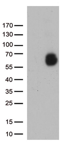 GPC1 Monoclonal Antibody (OTI8F3), TrueMAB , OriGene:Antibodies:Primary