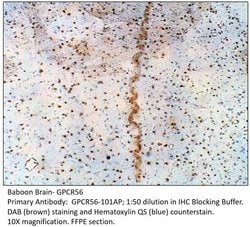 GPR56 Extracellular domain Rabbit anti-Human, Mouse, Non-human Primate,