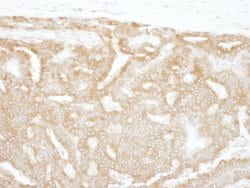 GPI Rabbit anti-Human, Polyclonal, Bethyl Laboratories 100 &mu;L; Unconjugated:Antibodies,