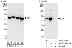 GPI Rabbit anti-Human, Polyclonal, Bethyl Laboratories 100 &mu;L; Unconjugated:Antibodies,