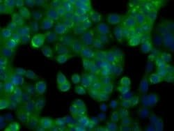 GPI Monoclonal Antibody (OTI8G7), TrueMAB , OriGene 100 &mu;L; Unconjugated:Antibodies,