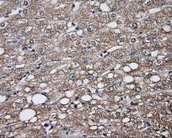 GPI Monoclonal Antibody (OTI8G7), TrueMAB , OriGene 100 &mu;L; Unconjugated:Antibodies,