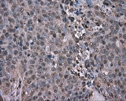 GPI Mouse anti-Human, Clone: OTI7G10, lyophilized, TrueMAB 100 &mu;g; Unconjugated:Antibodies,