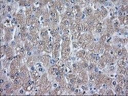 GPI Monoclonal Antibody (OTI5A11), TrueMAB , OriGene 100 &mu;L | Buy Online | OriGene | Fisher Scientific