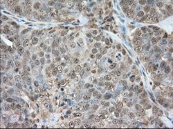 GPI Mouse anti-Human, Clone: OTI2D2, lyophilized, TrueMAB 100 &mu;g; Unconjugated:Antibodies,